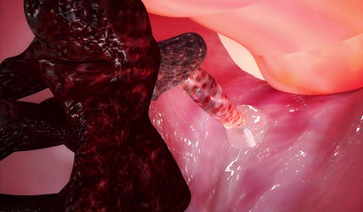 Big spider put little spiders in the pussy of a tied girl